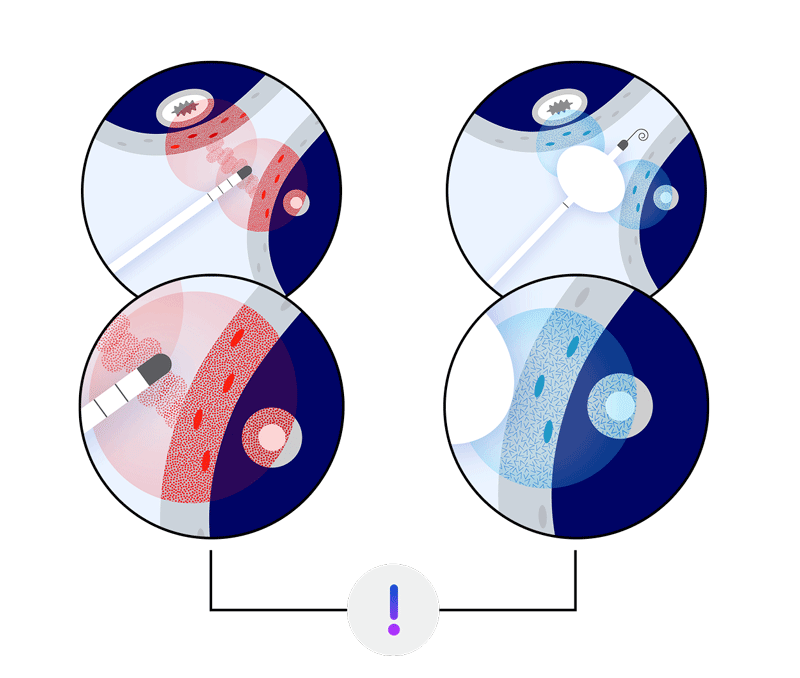 Illustration of traditional cardiac ablation showing how hot or cold thermal energy can cause collateral damage to nearby tissues such as the esophagus or phrenic nerve.